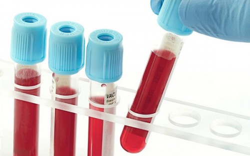 Hướng dẫn đọc các chỉ số xét nghiệm máu
